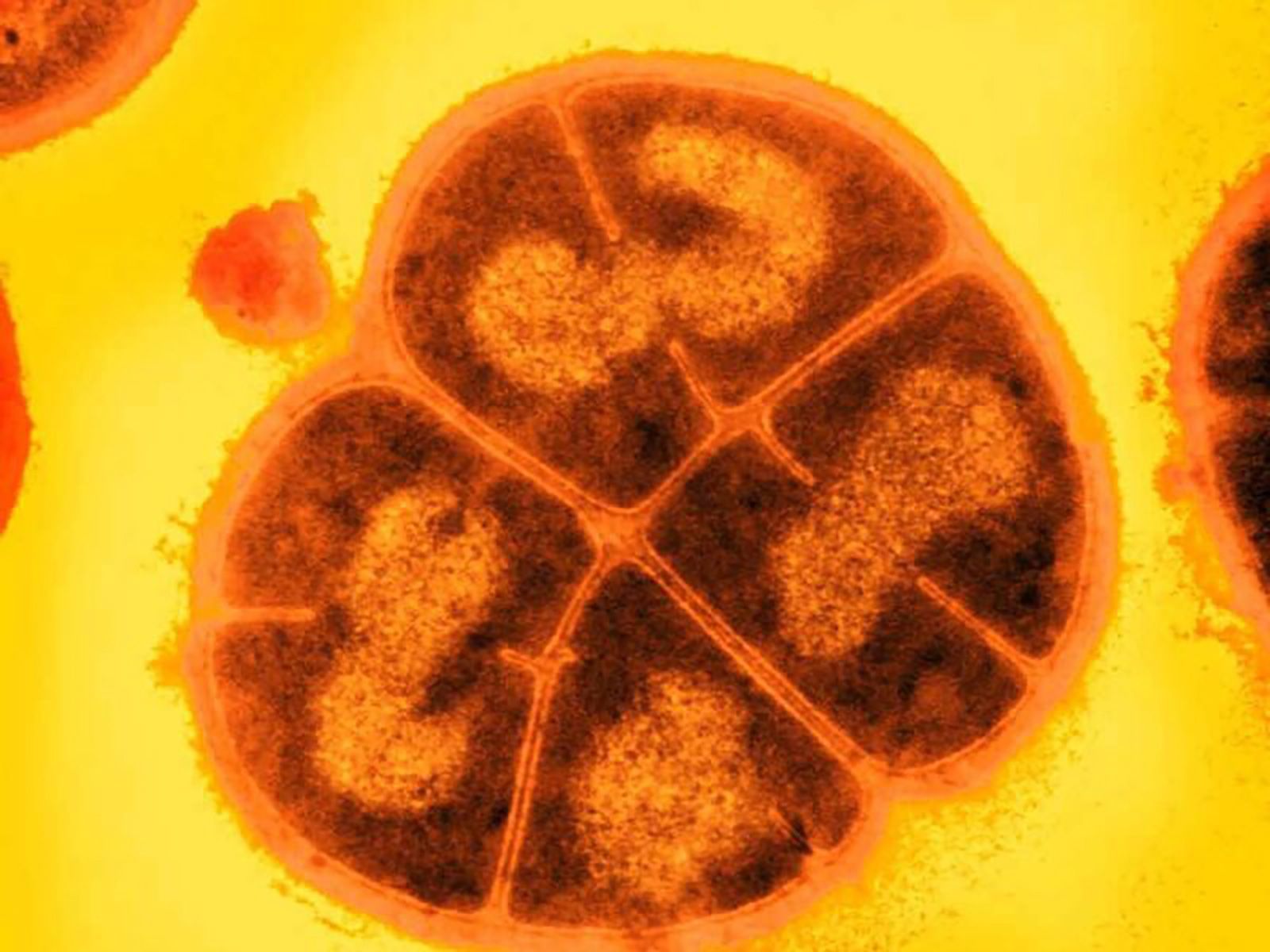 A Deinococcus radiodurans, também chamada de “Conan, a bactéria” pelos cientistas, é vista em um microscópio
