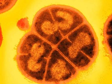 A Deinococcus radiodurans, também chamada de “Conan, a bactéria” pelos cientistas, é vista em um microscópio