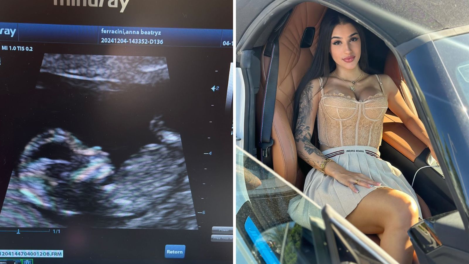 Bia Miranda mostra ultrassom do segundo filho