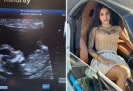 Bia Miranda mostra ultrassom da segunda gravidez e brinca: "Barriga intacta"