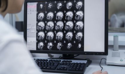 O que é hemorragia intracraniana e quais são as causas? Entenda