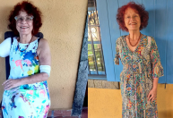 Escritora que perdeu braço após ataque de pitbulls no RJ irá receber prótese