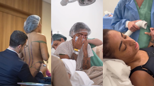 Em um vídeo, Loma mostrou como foi seu dia a caminho do hospital, o quarto em que ficou internada, as marcações feitas para a operação e cenas dos médicos fazendo os procedimentos no corpo da artista