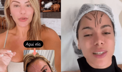 Poliana Rocha se identifica com Anitta e diz também ter veia aparente na testa