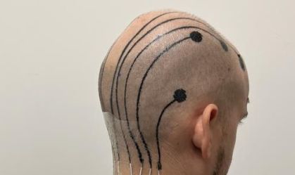 Cientistas criam tatuagem feita no couro cabeludo que mede atividade cerebral