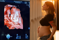 Isabel Veloso mostra ultrassom de primeiro filho: "Lindo demais"