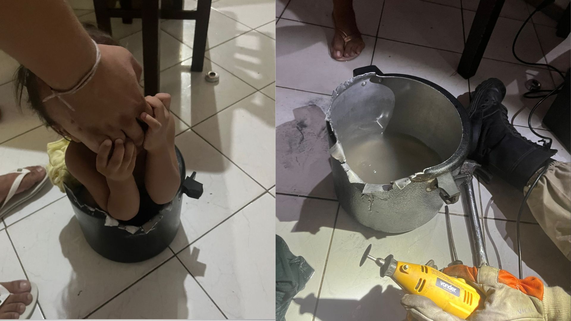 Bebê preso em panela de pressão