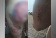 Soldado espancado no Exército tem crises de pânico ao lembrar de violência