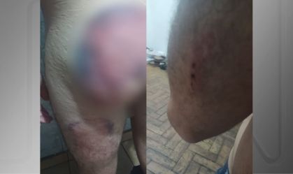 Soldado espancado no Exército tem crises de pânico ao lembrar de violência