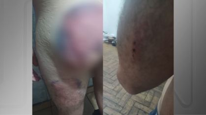 Soldado do Exército ficou com hematomas após ser agredido por colegas em quartel em SP