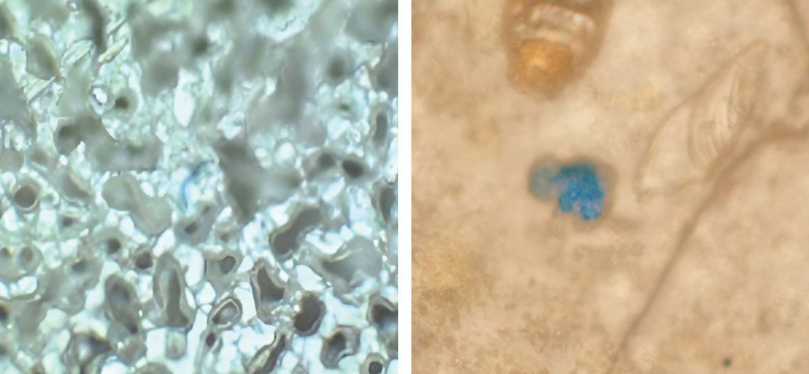 Imagem de microscopia de partícula de microplástico (azul) no pulmão (à esq.) e no tecido cerebral (à dir.) • Fernando Amato Lourenço / Universidade Livre de Berlim