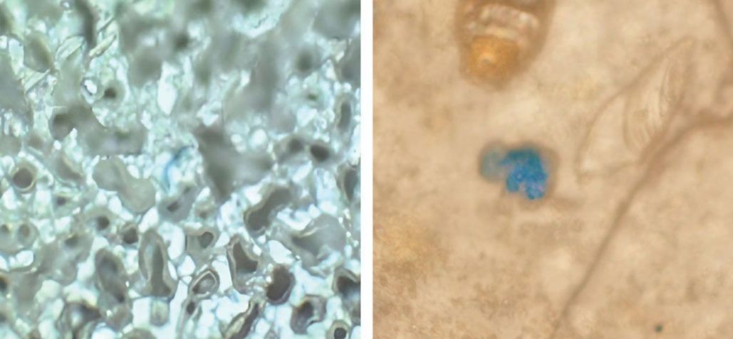 Imagem de microscopia de partícula de microplástico (azul) no pulmão (à esq.) e no tecido cerebral (à dir.) • Fernando Amato Lourenço / Universidade Livre de Berlim