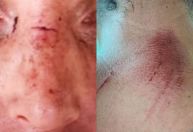 Mulher denuncia companheiro após descumprimento de medida protetiva