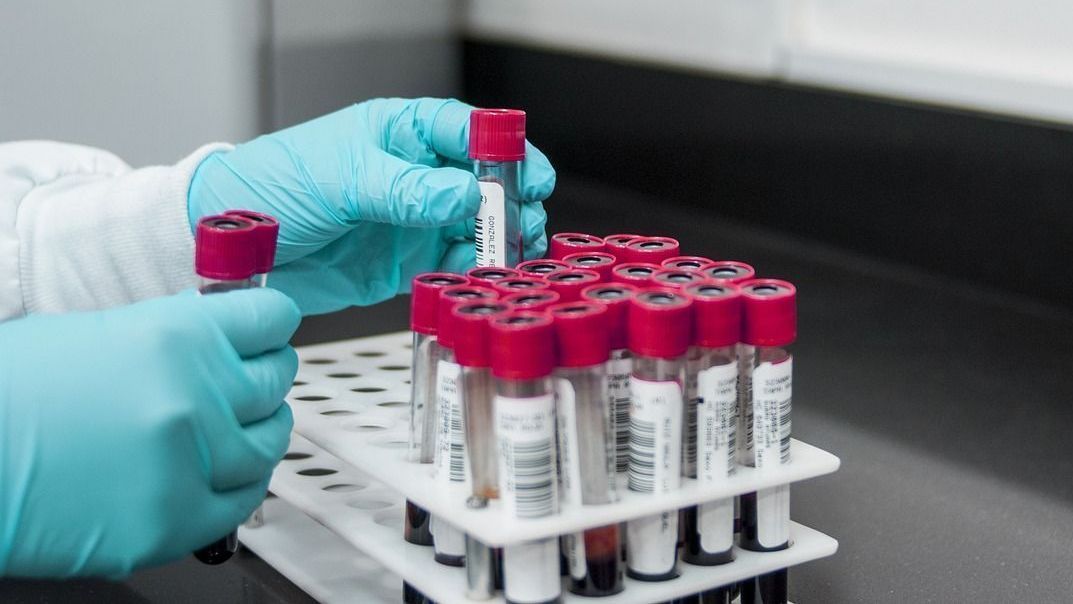 Novos tratamentos para doenças do sangue: Kalil e hematologistas comentam | CNN Brasil