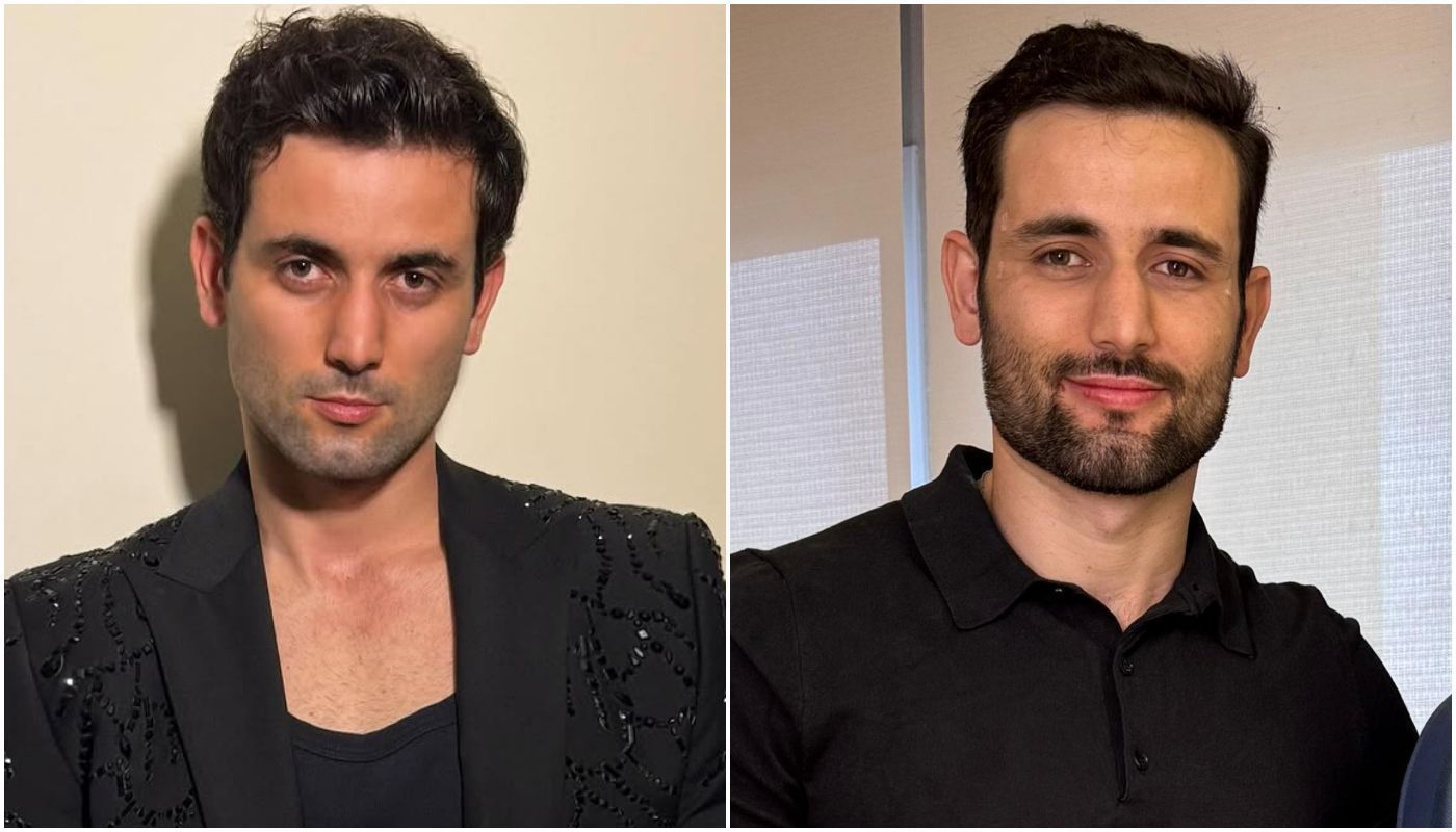 Matteus Amaral faz harmonização facial • Instagram / Matteus Amaral