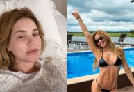 Virginia passa por duas cirurgias de uma vez: entenda riscos e benefícios
