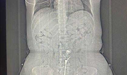 WhatsApp Image 2025-02-15 at 16.04.59