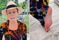 Ana Maria Braga dá detalhes sobre picada de escorpião; veja vídeo