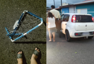 SP: menino é atropelado por carro enquanto jogava bola e fratura perna