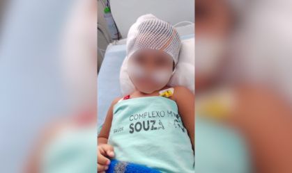 Menina de 2 anos que foi baleada na cabeça recebe alta no RJ