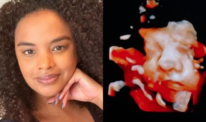 Grávida, Lucy Ramos mostra rosto da filha em ultrassom; veja