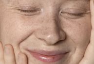 Mulheres são mais suscetíveis ao melasma; saiba por que e como prevenir