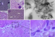 Cérebro humano registrou 50% mais nanoplásticos em 8 anos, diz estudo