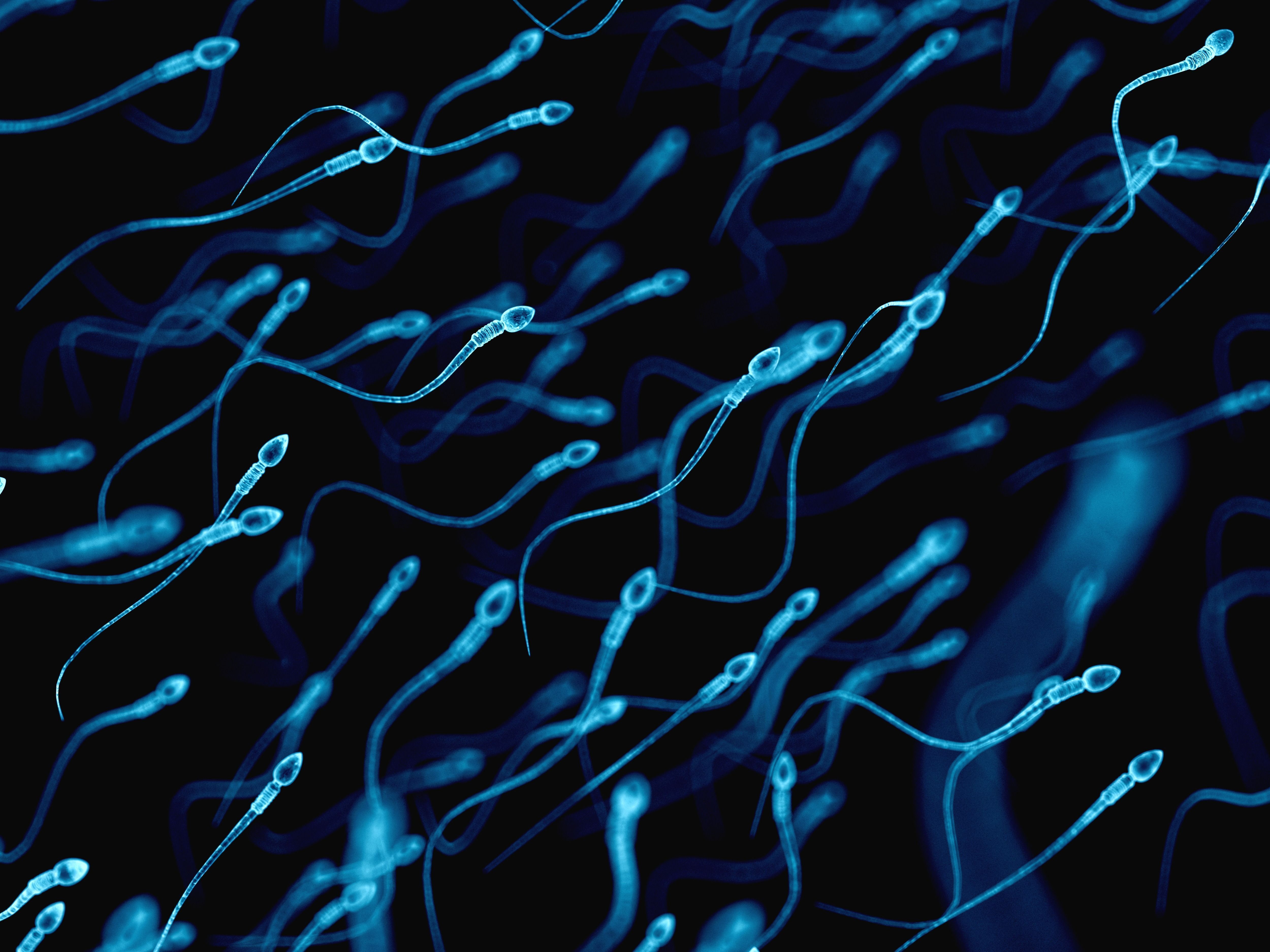 Human sperm