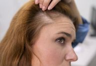 Alopécia genética: entenda condição e por que afeta homens e mulheres