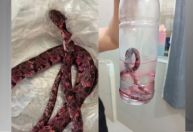 Homem passa mal após tentar comer cobra para "provar masculinidade"