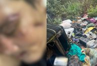Couro cabeludo arrancado: homem é preso por tentativa de feminicídio em SP