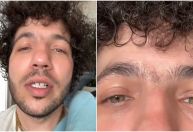 Noivo de Selena Gomez, Benny Blanco tira sobrancelha e mostra mudança