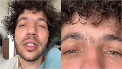 Benny Blanco faz a sobrancelha e mostra mudança no visual