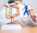 Câncer colorretal: como diminuir o risco da doença