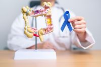 Estudo associa toxina de bactéria a câncer colorretal em jovens
