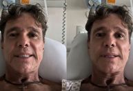Netinho raspa a cabeça após início do tratamento para o câncer
