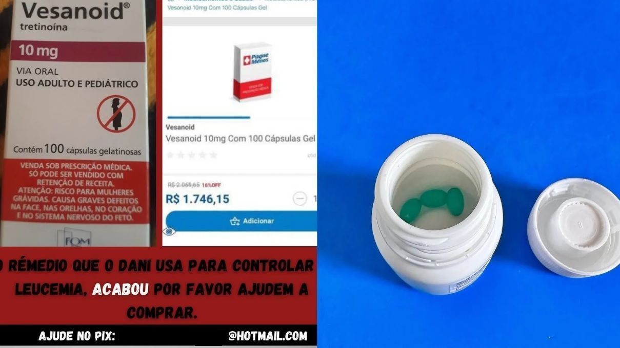 fotogolpe