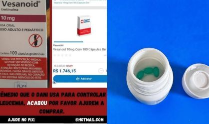 fotogolpe