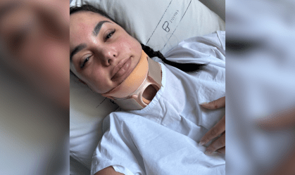Cabelo preso em piscina: entenda como mulher sobreviveu após quebrar coluna