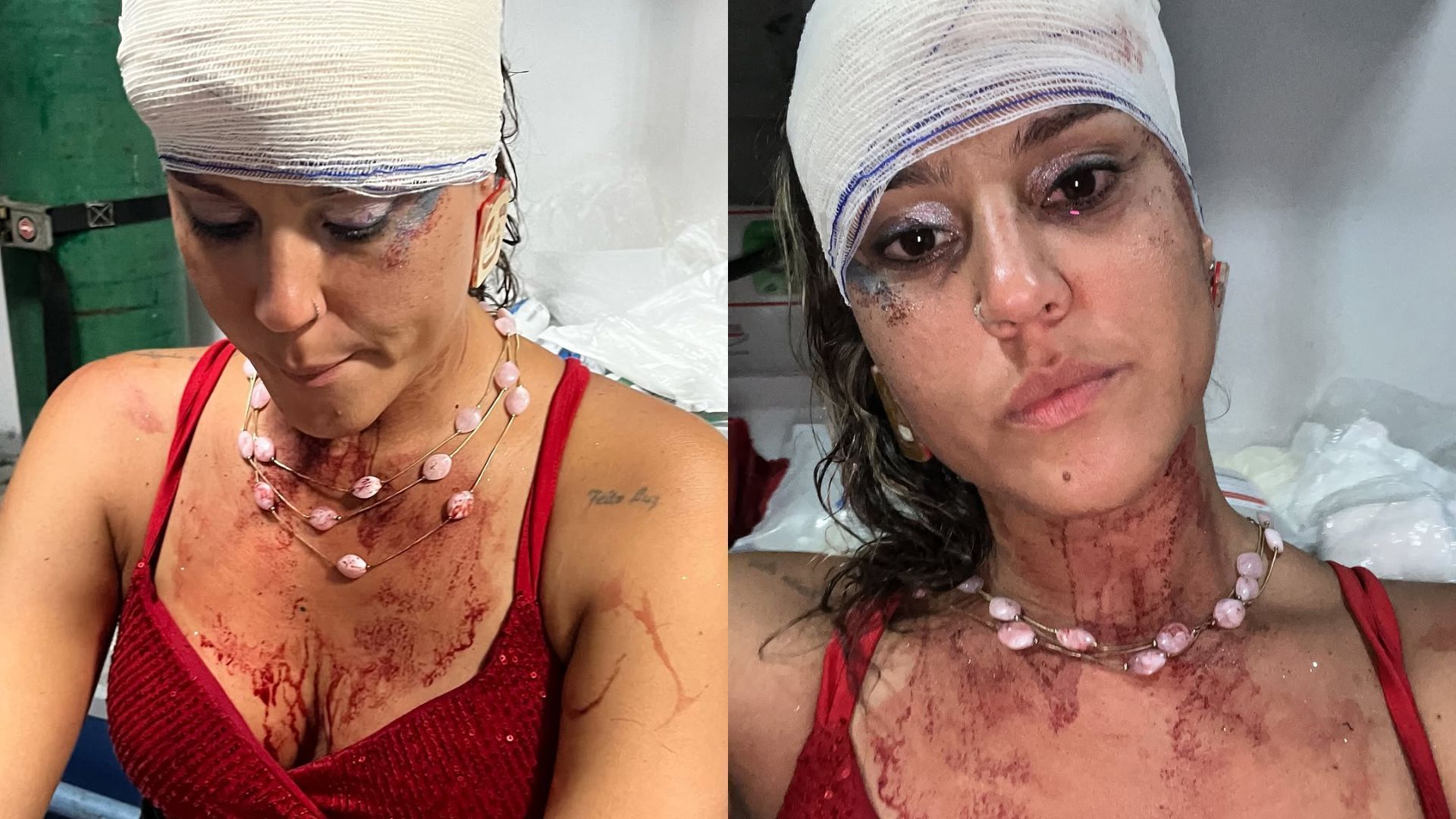 Mulher denuncia agressão por PMs durante bloquinho