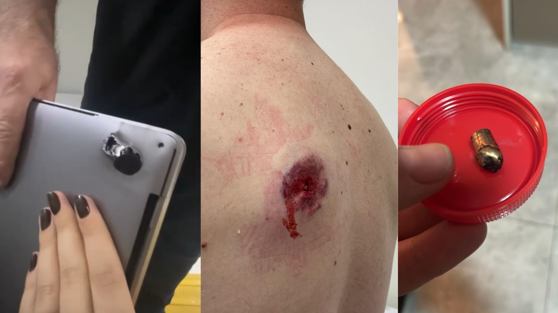 Homem é baleado e sobrevive graças a notebook na mochila; entenda