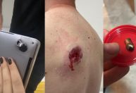 SP: Baleado durante assalto, homem sobrevive graças a notebook na mochila