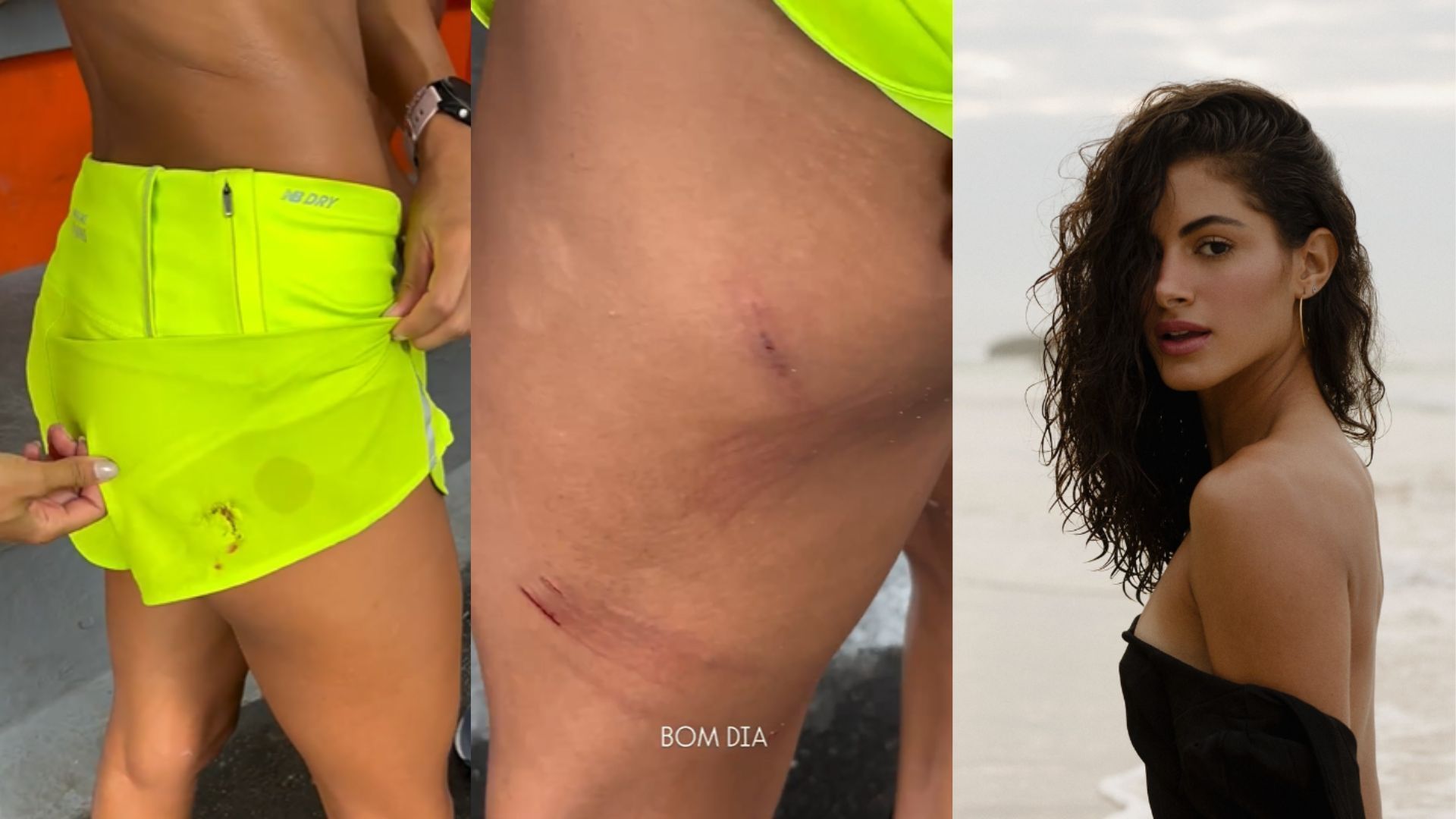 Atriz é atacada por cinco cães em praia do Rio de Janeiro