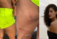 Atriz é atacada por cinco cães em orla da praia de Maricá (RJ)
