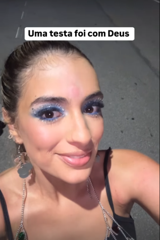 A jovem ganhou um galo na testa • Instagram/Julia Puzzuoli