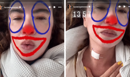 Luciana Gimenez desabafa após cirurgia: "Está sendo uma tortura"