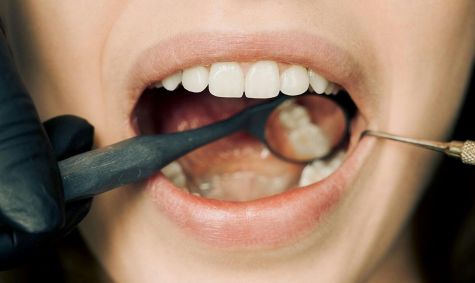 Mulher com a boca aberta. Instrumentos bucais, como espelhinhos, posicionam dentro dela.