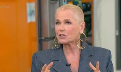 Alopécia androgenética: entenda condição de Xuxa e por que afeta mulheres
