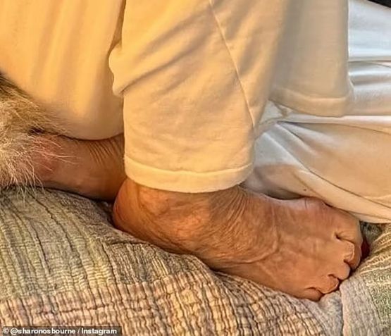 O "pé de Ozempic" adiciona mais uma estética a ser julgada publicamente • Sharon Osbourne/Instagram