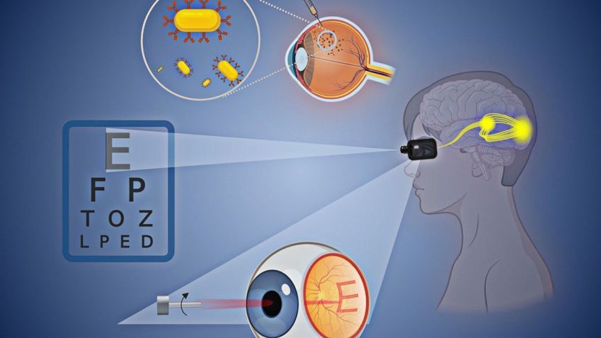 A integração entre hardware e biologia promete redefinir o tratamento das deficiências visuais • Brown University